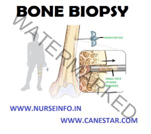 BONE BIOPSY - Nurse Info