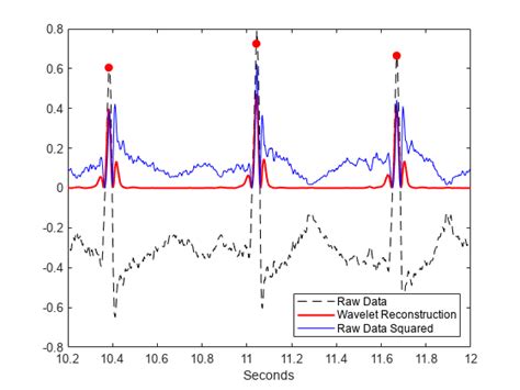 R Wave Detection in the ECG - MATLAB & Simulink - MathWorks Italia