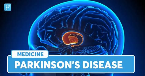 Parkinson's Disease: Causes, Symptoms, Diagnosis, Treatment and Prognosis