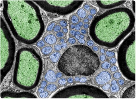 Schwann cells induce self-repair of damaged nerves