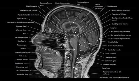 Brain Atlas Of Human Anatomy With Mri Mri Brain Mri Anatomy | Images and Photos finder
