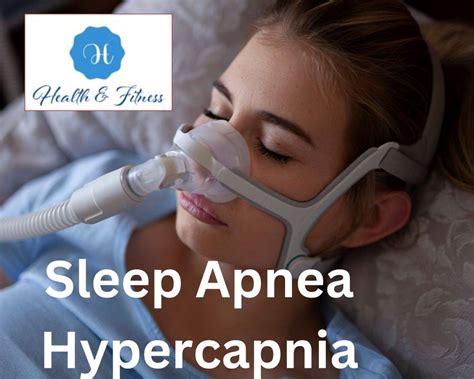 Sleep Apnea Hypercapnia High Carbon Dioxide Retention - Fitness & Health Nextfitlife