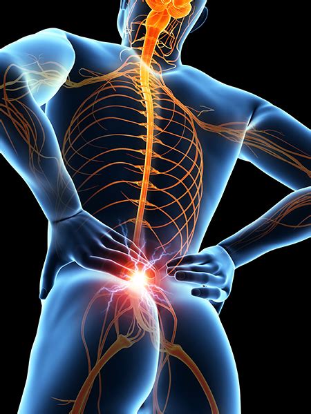 Sacroiliac Joint Injection - Ainsworth Institute