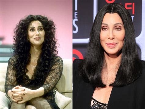 Goddess Of Pop, Cher Plastic Surgery Before And After Photos - CelebLens.Com