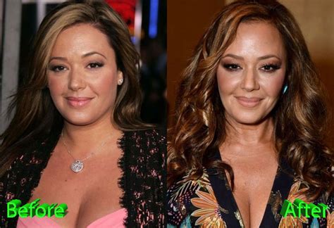 Leah Remini Plastic Surgery: Forever Young Leah