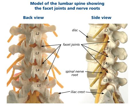 Facet Joint Disease - Spines Dorset