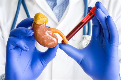 What is Creatinine?