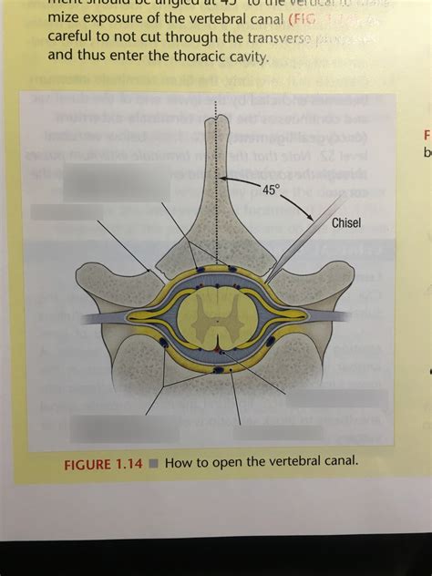 Vertebral canal Diagram | Quizlet