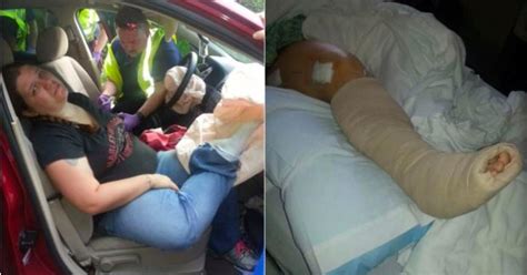 Woman With Feet On Dashboard Habit Survives Wreck; Painful Lesson ...