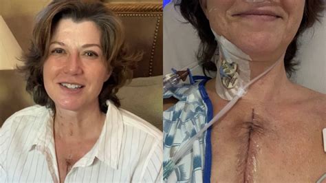 Amy Grant Shares Photos After Undergoing Open Heart Surgery