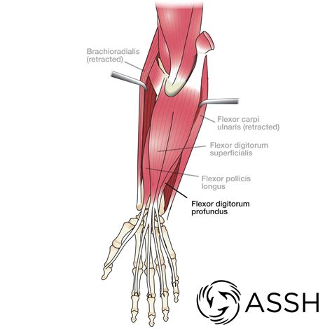 Flexor Digitorum Muscle