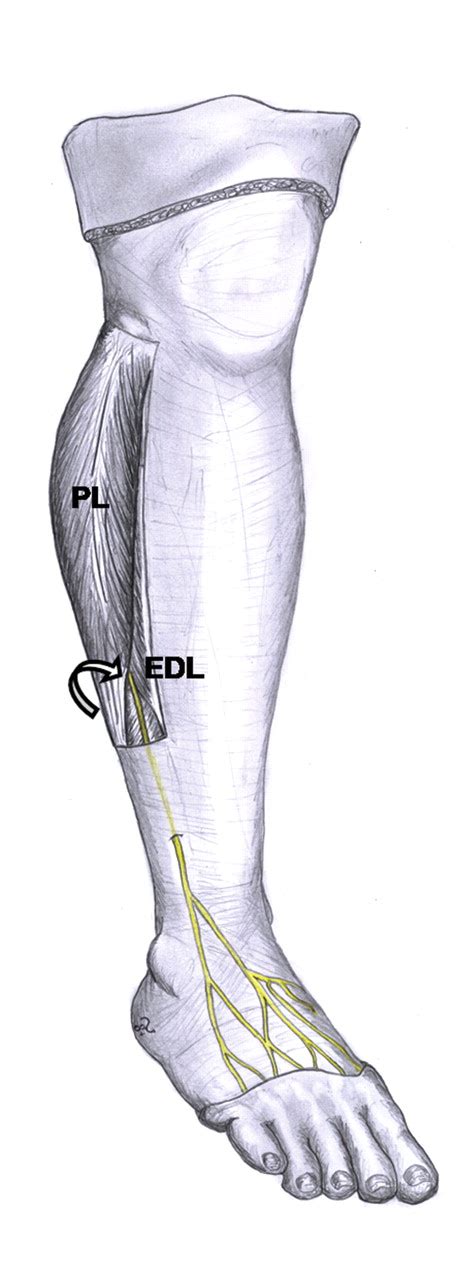 Superficial Peroneal Nerve Anatomy Everything You Need To, 49% OFF