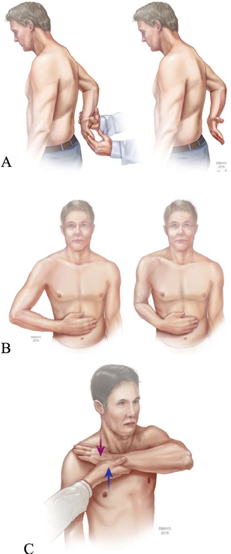 Subscapularis Test