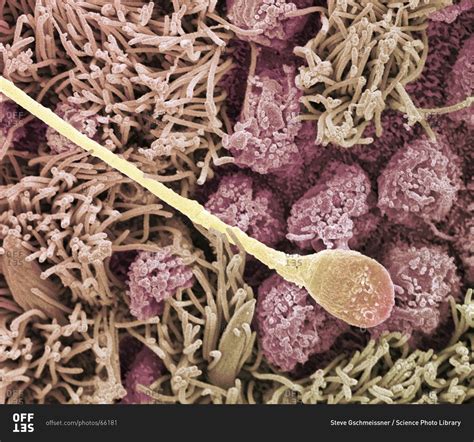 Magnification view of a Sperm cell under a Color scanning electron micrograph stock photo - OFFSET