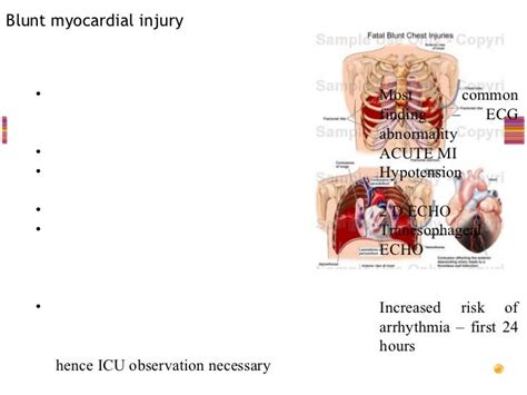 Chest trauma