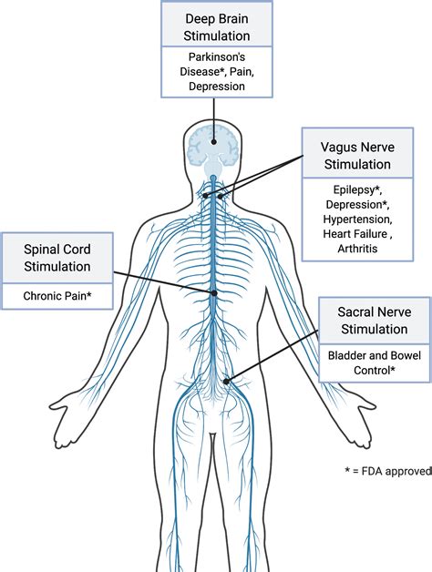 Next-Generation Bioelectric Medicine: Harnessing the Therapeutic Potential of Neural Implants ...