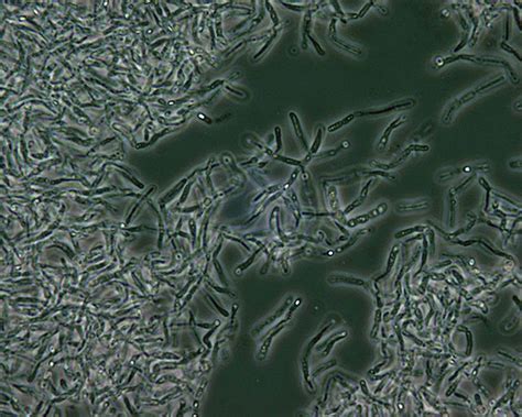 Free picture: bacillus, anthracis, spores, phase, contrast, microscopy