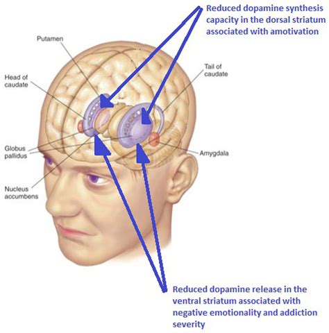 Cannabis use in humans is associated with reduced dopamine in the... | Download Scientific Diagram