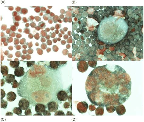 Morphological changes observed in K562 cells after 72-h exposure to 15 ...