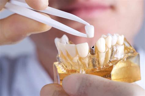 Innovations in the Dental Implant Industry