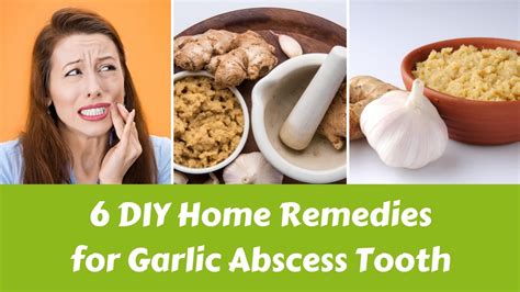 6 DIY Home Remedies for Garlic Abscess Tooth - YouTube