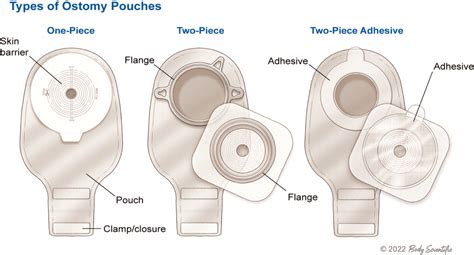 Ileostomy Information l United Ostomy Associations of America