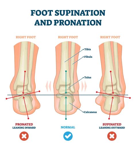 What Runners Should Know About Supination – ActiveBeat – Your Daily ...