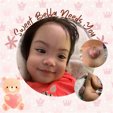 Bella with Spina Bifida - FundraiserMe | Crowdfunding Platform
