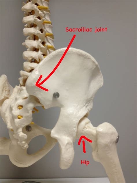 Hip Pain or Sacroiliac Joint Pain? - Treatment in Burlington