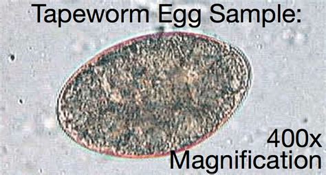 The Tapeworm I Found in my Salad Dressing with a Microscope – The Blog ...