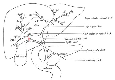 FULL TEXT - Management of an injured accessory hepatic duct during ...