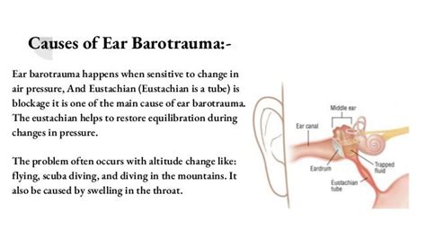 Ear barotrauma causes, symptoms and treatment