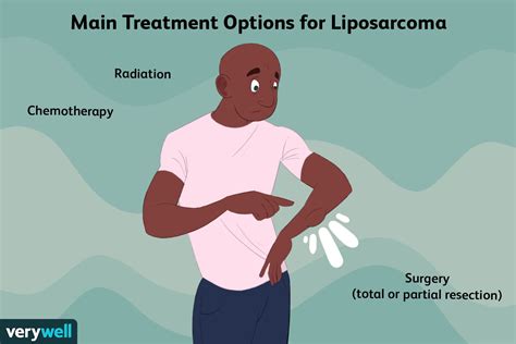 Liposarcoma Treatment: Surgery, Radiation, Chemotherapy