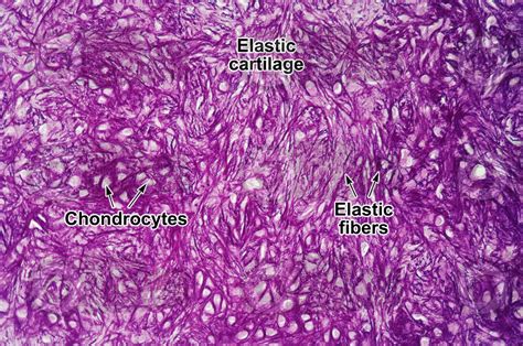 Mammal. Elastic cartilage. Transverse section. 125X - Elastic cartilage ...