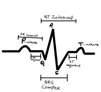 Ecg Waves Labeled | Hot Sex Picture