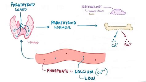 Hypophosphatemia