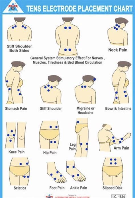 Pin by Jane Long on Health care | Tens electrodes, Tens unit therapy ...