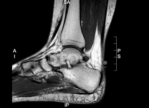 Ankle Mri Stock Photo | Royalty-Free | FreeImages