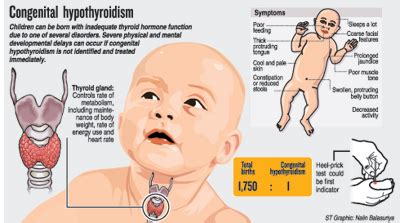 How to prevent congenital Hypothyroidism in Children