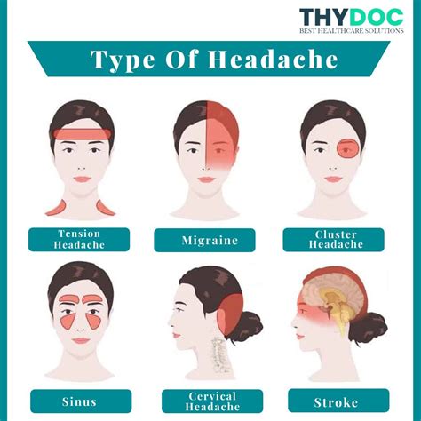 Type of Headache | Headache treatment, Migraine headaches, Headache types