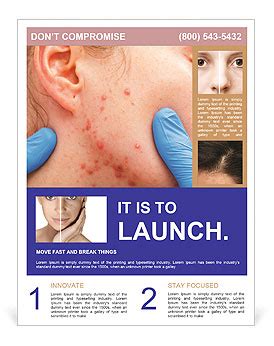 Sebaceous Gland Disorders: Understanding The Link To Acne Flyer Template & Design ID 0000077155 ...