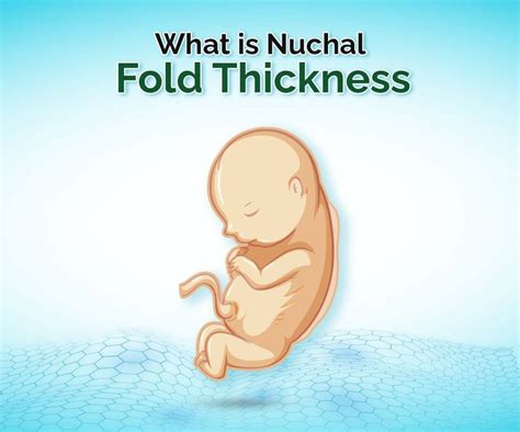 Nuchal Fold Thickness: Normal or abnormal? Expert insights in 2023