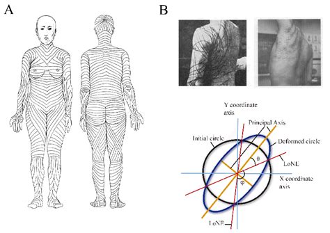 [DIAGRAM] Skin Tension Lines Diagram Arm - MYDIAGRAM.ONLINE