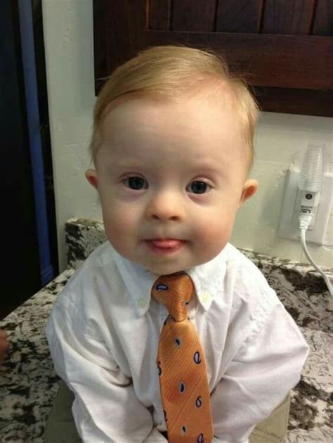 This sweet baby has Downs Syndrome. Is he not the Cutest? Don't you ...