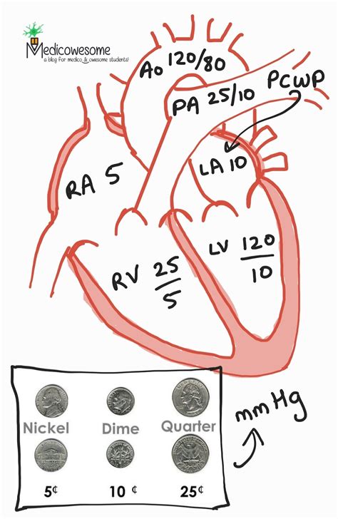 Medicowesome: Normal cardiac pressures mnemonic (Normal Swan-Ganz pressures)