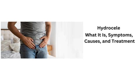 Hydrocele: What Its Causes, Symptoms, Prevention and Treatments