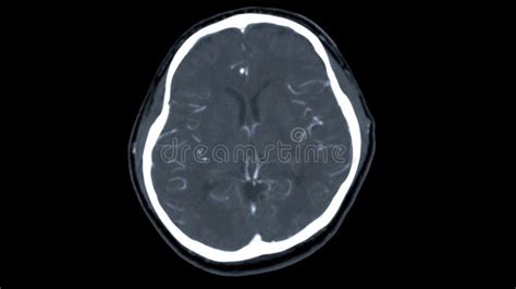 143 Ct Scan Brain Contrast Media Stock Photos - Free & Royalty-Free Stock Photos from Dreamstime