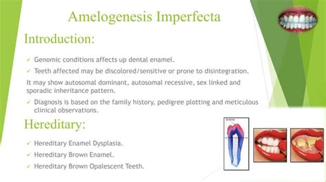 Amelogenesis imperfecta | PPT