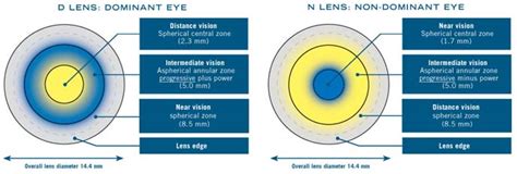 The 34th British Contact Lens Association Clinical Conference (BLCA) - Charl Laas Optometrists