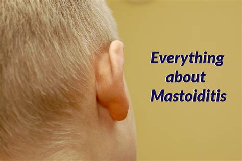 Everything about Mastoiditis ~ Vikram ENT Hospital & Research Institute